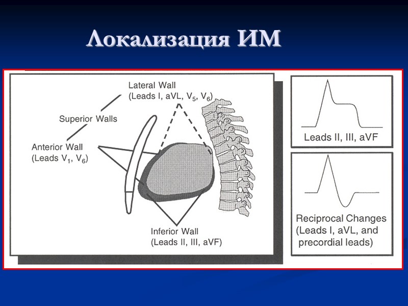 Локализация ИМ